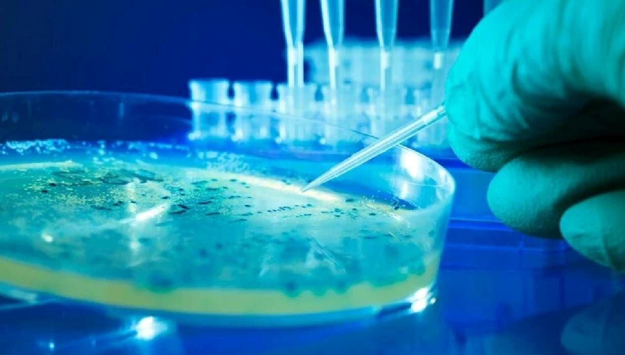 abdde salmonella alarmi qrQQSWGD