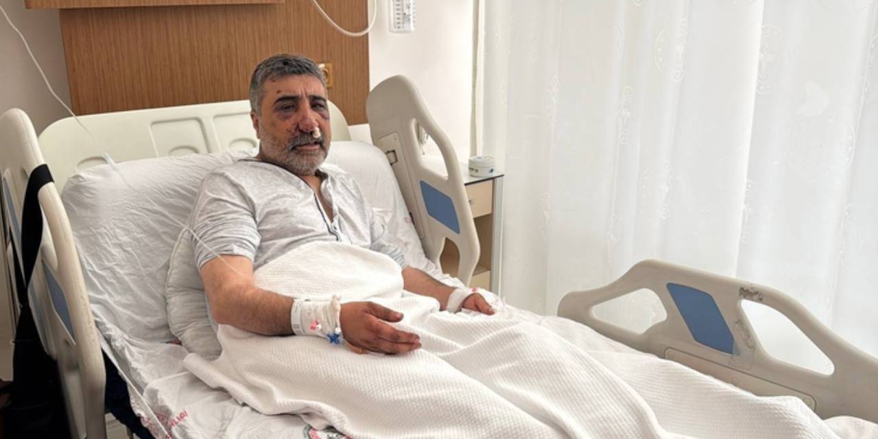 ingiliz boksorun darp ettigi taksicinin davasi goruldu geceleri bagirarak uyaniyorum Y7MxKnVC.jpg