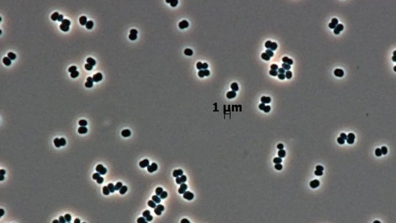 olu taklidi yapan super bakteriler uzayi bile tehdit ediyor O2dhImY7.jpg